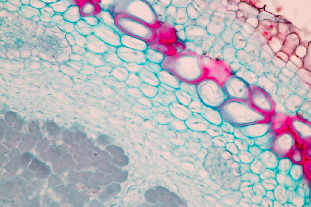 Mycorrhizae under a microscope.