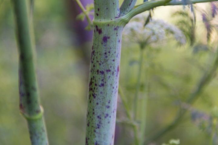 Horrifying Photos Plants Growing Under The Skin - 21spst4
