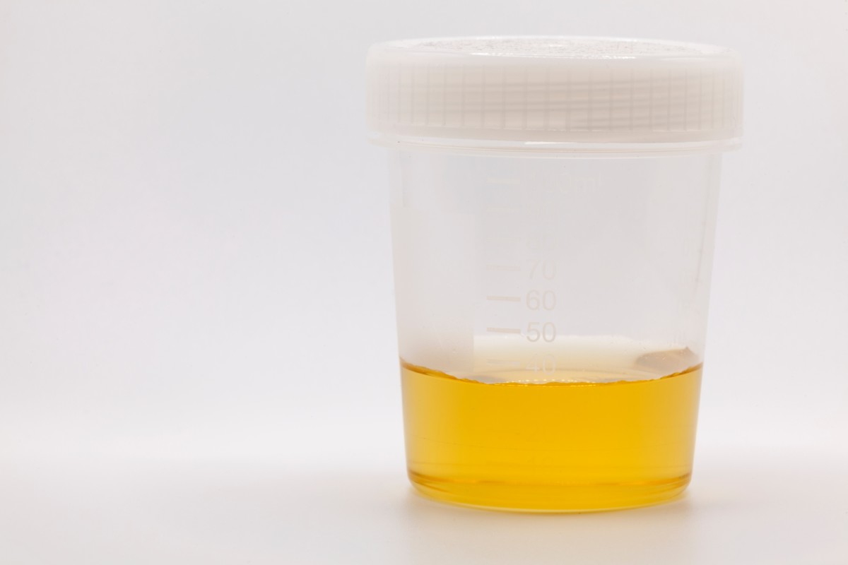 Specimen cup with urine